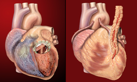 चित्र:Human-Heart.jpg