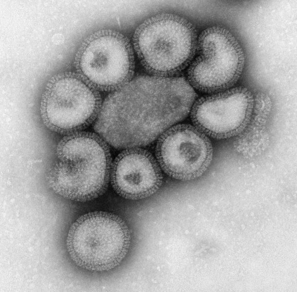 चित्र:Influenza-Virus.jpg