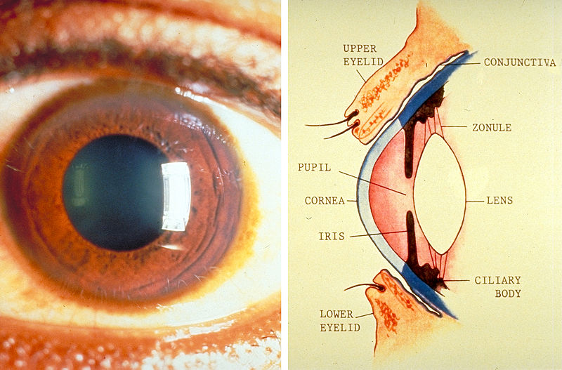 चित्र:Eye-3.jpg